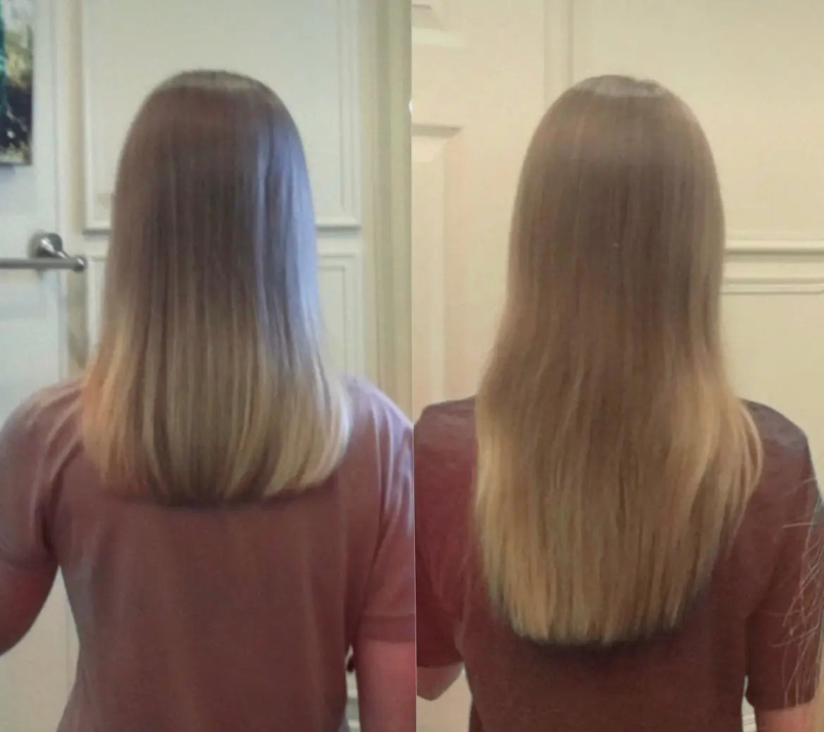Anzaga - Hair, Skin and Nails -Pelo,Piel y Uñas anzaga.com